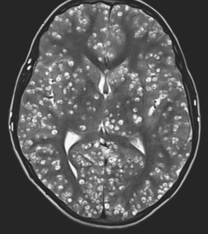 Reason for Elizabeth May’s Erratic Behaviour Finally Revealed: “Brain Bugs,” Eh?